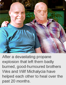 After a devastating propane explosion that left them badly burned, good-humoured brothers Wes and Wilf Michalycia have helped each other to heal over the past 20 months