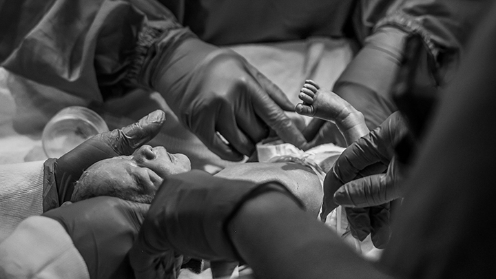 A premature twin is assessed by the neonatal team shortly after birth at Foothills Medical Centre in Calgary.