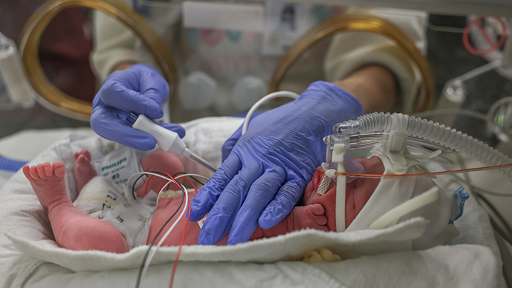 A neonatal team member checks a baby's temperature in the NICU at Foothills Medical Centre.