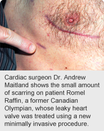 Romel Raffin's tiny scar
