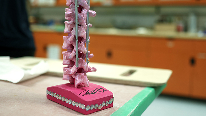 Patient Cindy Bourassa added glitter and gemstones when she assembled and customized this 3D-printed model of her spine “My spine is my most favourite (work of art). I learned more about what happened to me — and accepted what happened to me. (My recreation therapist) Michelle (Haley) was great, teaching me the different parts and putting it together.”