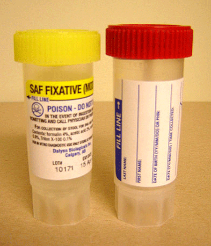 Alberta Precision Laboratories Lab Services